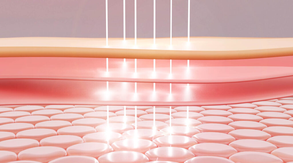 Laser,Or,Serum,Vitamin,Through,The,Skin,Layer,For,Repair