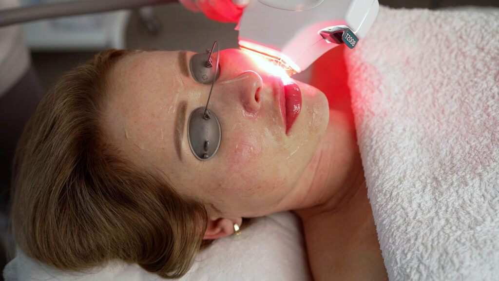 Beauty,Treatment.,Hifu,Treatment,On,Female,Face.,High,Intensity,Focused